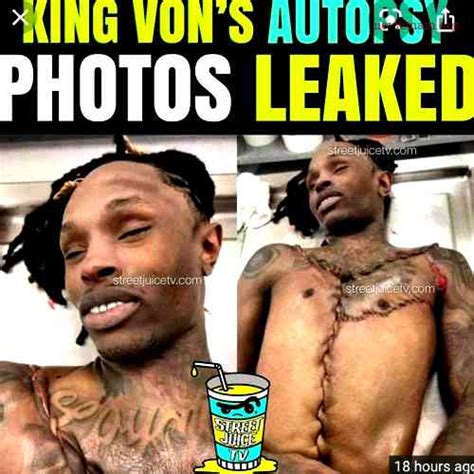 The image was deleted, but not before it was widely shared on social media platforms. . King von autopsy pic